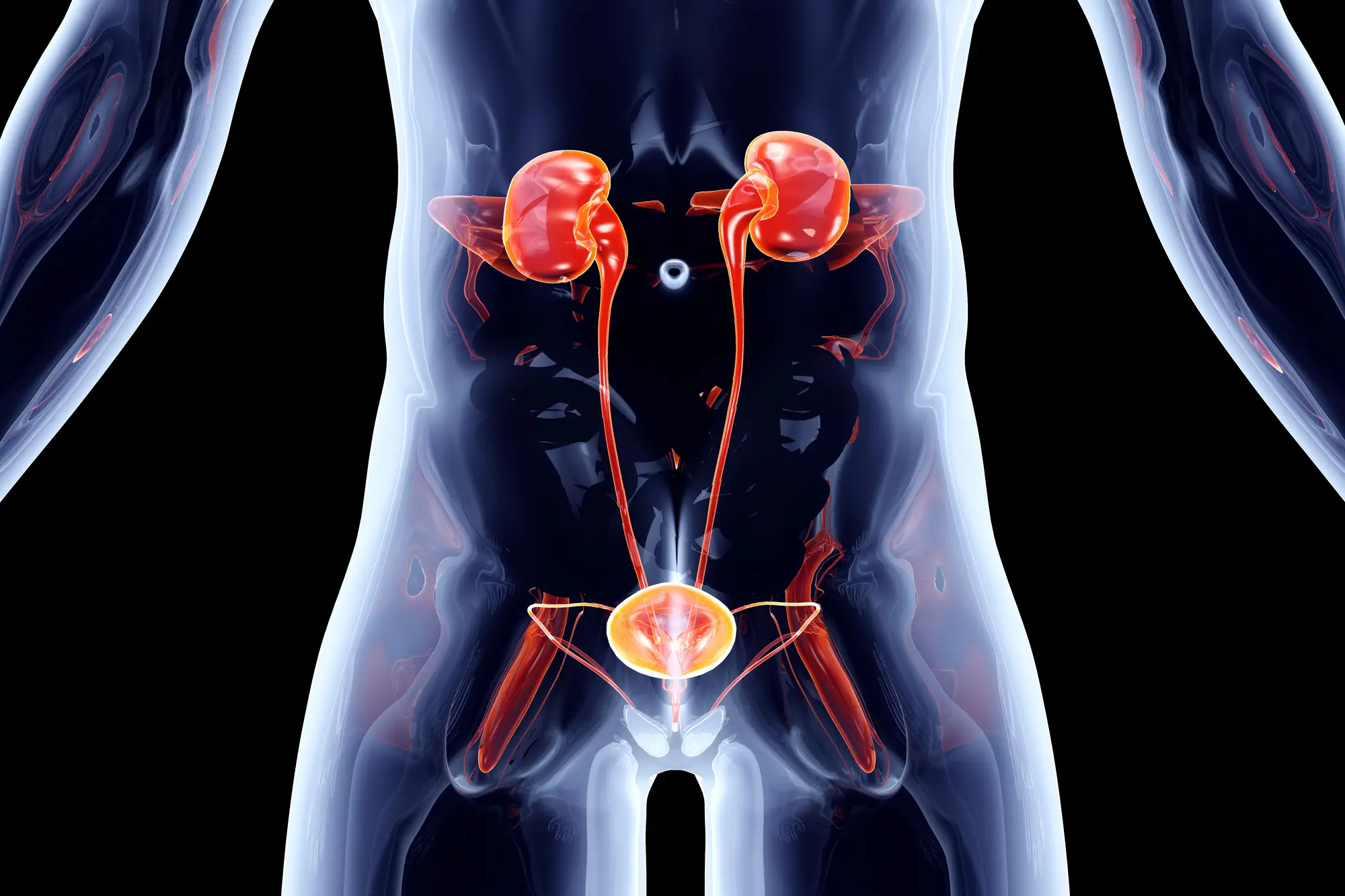 Vejiga hiperactiva